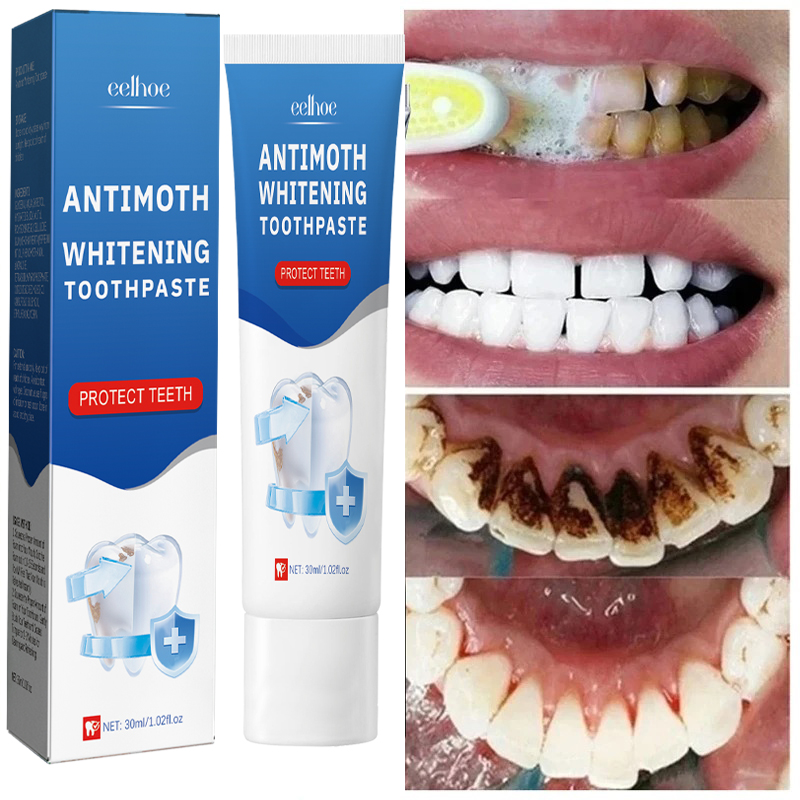 Fast Remove Smoke Stains Tooth - Teeth Whitening Fast ulasan dan harga