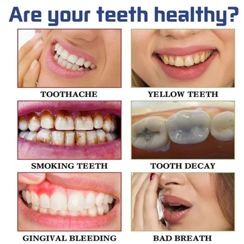 Fast Remove Smoke Stains Tooth - Teeth Whitening Fast ulasan dan harga