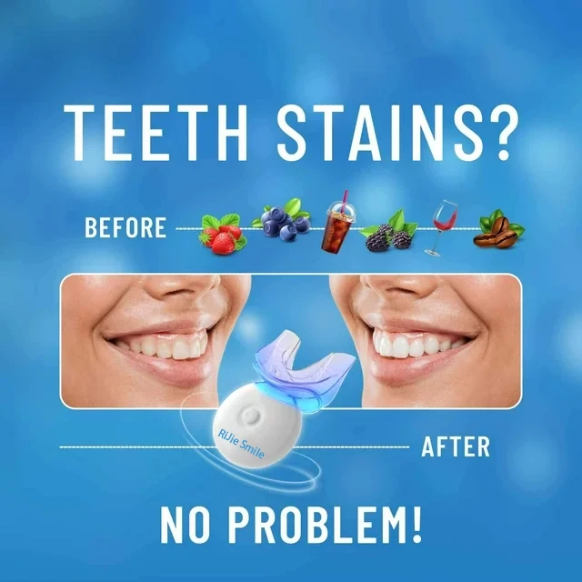 High Quality Cleaning Kit Wire - Teeth Whitening At Home Kit ulasan dan harga