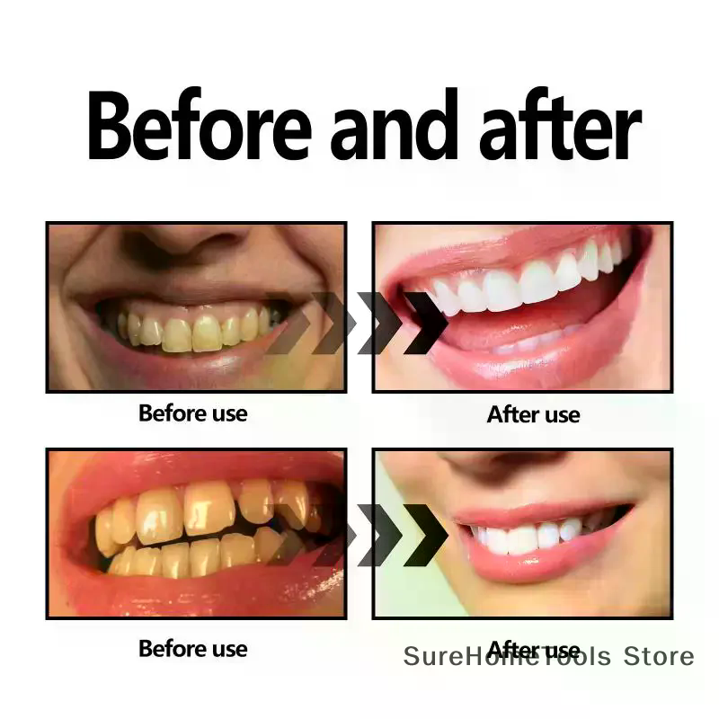 Bamboo Charcoal Powder For Tee - Teeth Whitening Charcoal ulasan dan harga