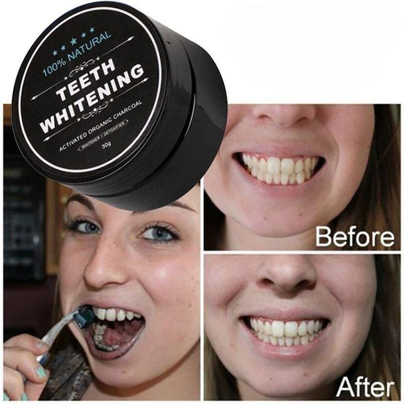 1 Box Activated Charcoal Teeth - Teeth Whitening Charcoal ulasan dan harga