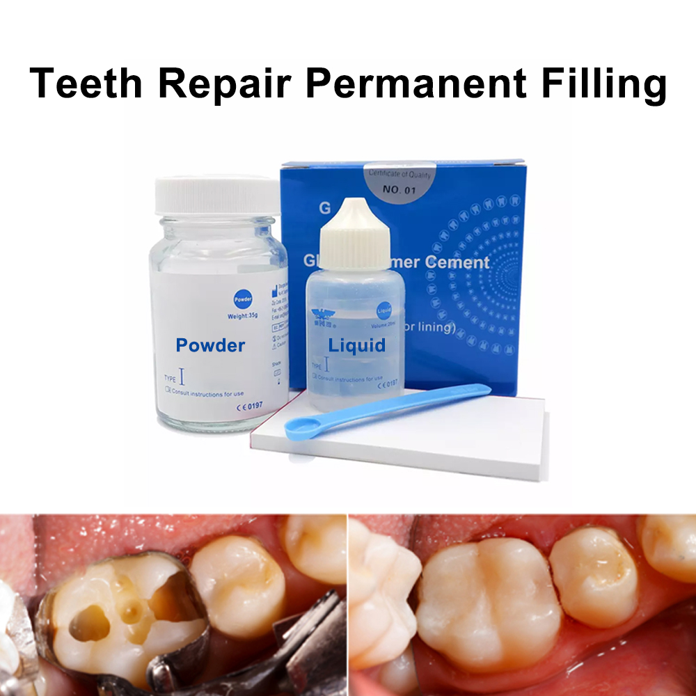 Permanent Teeth Filling Repair - Teeth Whitening At Home Kit ulasan dan harga