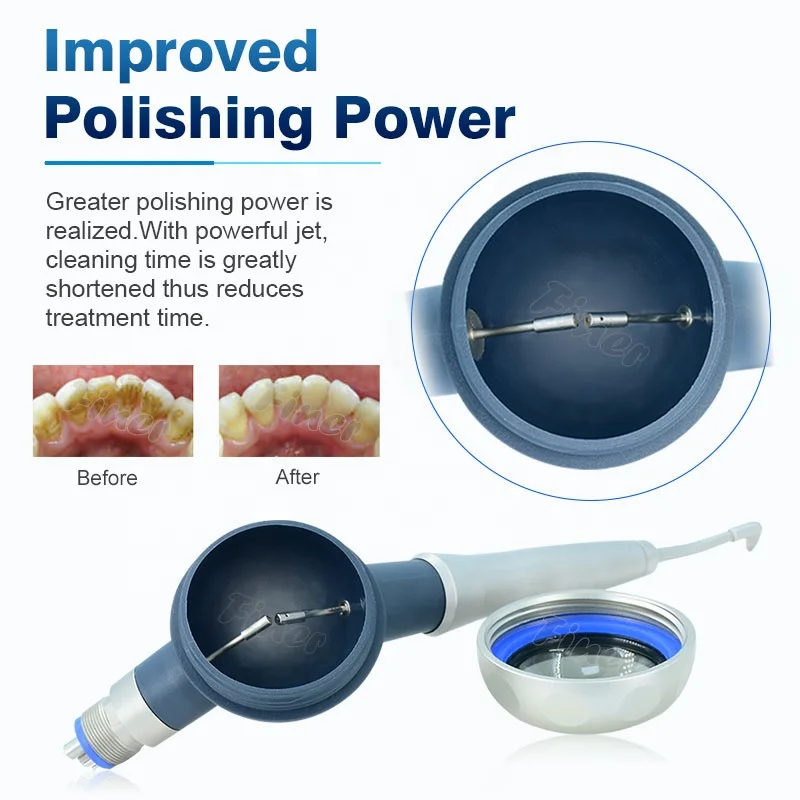 Prophy Mate Teeth Cleaning Whi - Teeth Whitening Fast ulasan dan harga