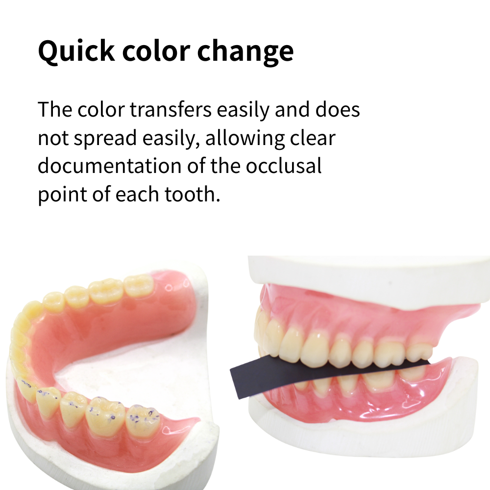 AG 300Pcs Occlusive Paper Dent - Teeth Whitening Strips ulasan dan harga